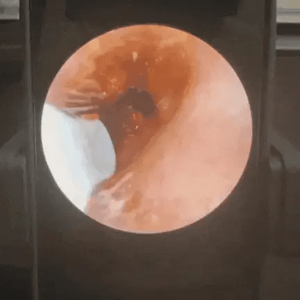 Orelis.co – Purifiant Auditif